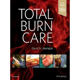 Total Burn Care