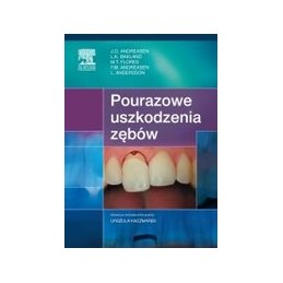 Pourazowe uszkodzenia zębów