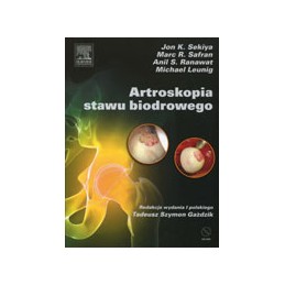 Artroskopia stawu biodrowego