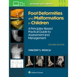 Foot Deformities and...