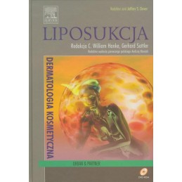 Liposukcja (Seria...