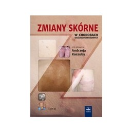 Zmiany skórne w chorobach ogólnoustrojowych. Tom 1