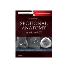 Sectional Anatomy by MRI...