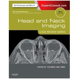 Head and Neck Imaging: Case...