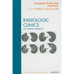 Imaging of Airway Diseases,...