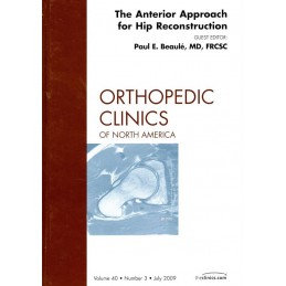 The Anterior Approach for...