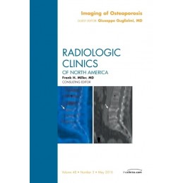 Imaging of Osteoporosis, An...