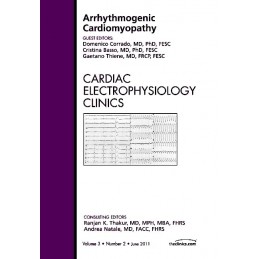 Arrhythmogenic...