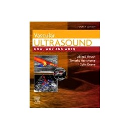 Vascular Ultrasound