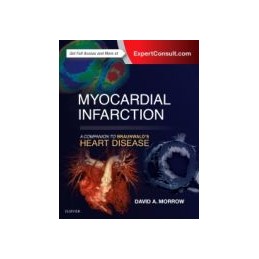 Myocardial Infarction: A...