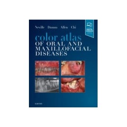 Color Atlas of Oral and Maxillofacial Diseases