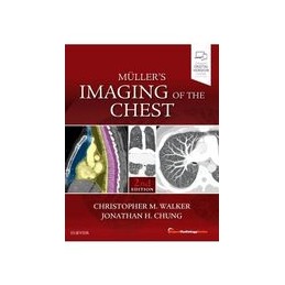 Muller's Imaging of the Chest