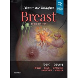 Diagnostic Imaging: Breast