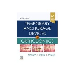 Temporary Anchorage Devices in Orthodontics