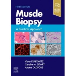 Muscle Biopsy