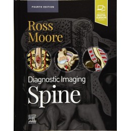 Diagnostic Imaging: Spine