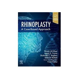 Rhinoplasty