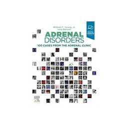 Adrenal Disorders