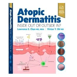 Atopic Dermatitis: Inside Out or Outside In