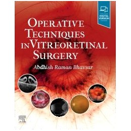 Operative Techniques in Vitreoretinal Surgery