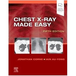 Chest X-Ray Made Easy