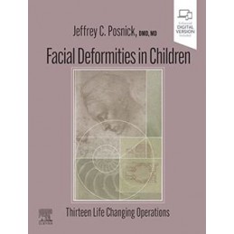 Facial Deformities in Children