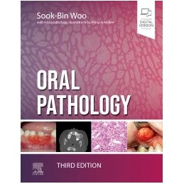 Oral Pathology