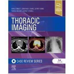 Thoracic Imaging: Case Review