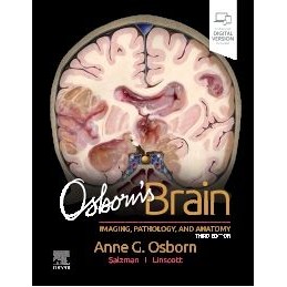 Osborn's Brain