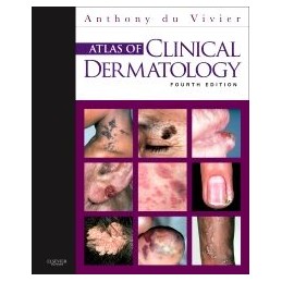 Atlas of Clinical Dermatology