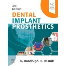 Dental Implant Prosthetics