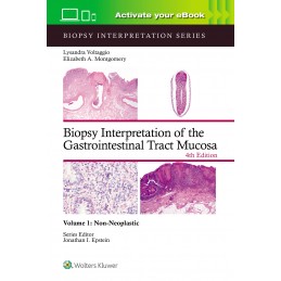 Biopsy Interpretation of the Gastrointestinal Tract Mucosa Volume 1: Non-Neoplastic: Print + digital version with Multimedia