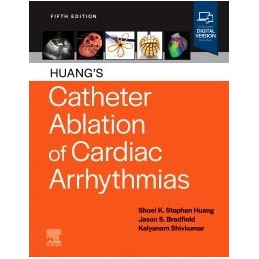 Huang's Catheter Ablation of Cardiac Arrhythmias