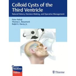 Colloid Cysts of the Third...