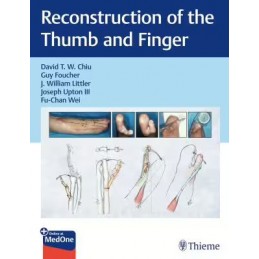 Reconstruction of the Thumb...