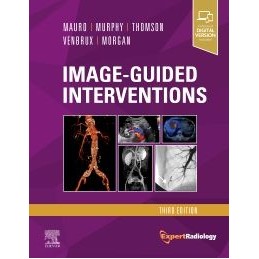 Image-Guided Interventions