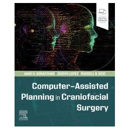 Computer-Assisted Planning in Craniofacial Surgery