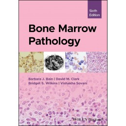 Bone Marrow Pathology