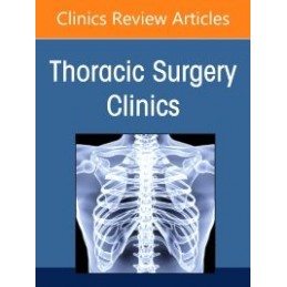 Pulmonary Metastasectomy,...