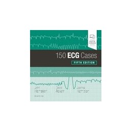 150 ECG Cases