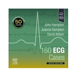 160 ECG Cases