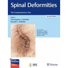 Spinal Deformities: The...