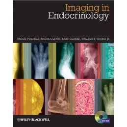 Imaging in Endocrinology