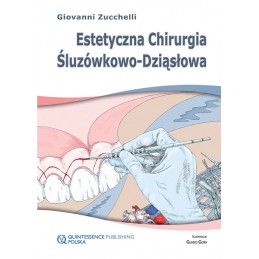 Estetyczna chirurgia śluzówkowo-dziąsłowa