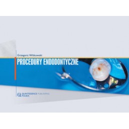 Procedury endodontyczne