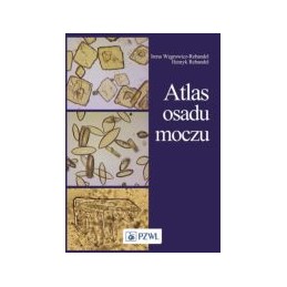 Atlas osadu moczu