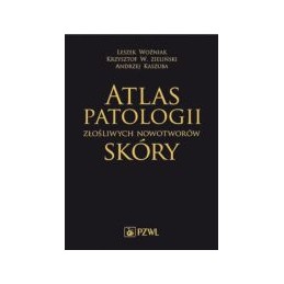 Atlas patologii złośliwych...