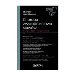 Choroba zwyrodnieniowa stawów - współczesne spojrzenie