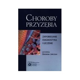 Choroby przyzębia -...