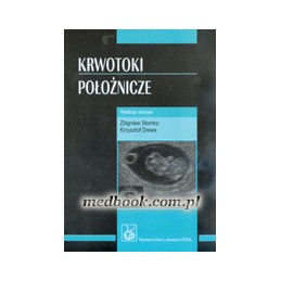 Krwotoki położnicze